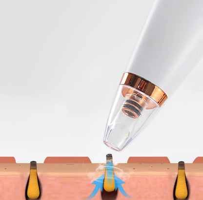 LIMPIADOR FACIAL/ LIMPIADOR DE POROS